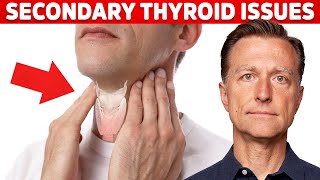 Most Thyroid Issues Are Secondary to Other Problems – Dr Berg [upl. by Monia401]