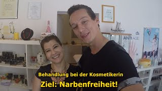 AKNEBehandlung bei der KOSMETIKERIN LIVE [upl. by Erie]