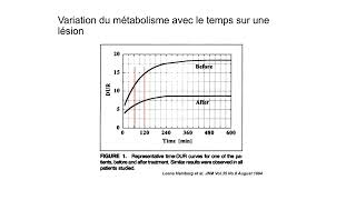 Evaluation de la réponse au traitement avec FDG PETCT critères EORTC et PERCIST [upl. by Andreana]