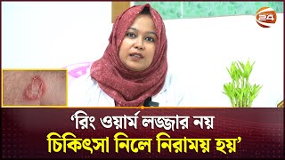 রিং ওয়ার্ম লজ্জার নয় চিকিৎসা নিলে নিরাময় হয়  Ring Worm  Channel 24 [upl. by Alma]