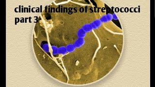 Clinical findings of streptococci  part 3 [upl. by Laux]