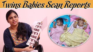 Twins Babies Scan Reports  To All My Sisters  TrichyTwins [upl. by Tsiuqram]