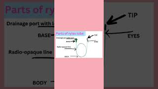 Nasogastric tuberyles tube part [upl. by Germin]