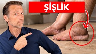 Şişmiş Bacak ve Ayak Bileklerini Gidermek İçin 1 Numaralı Vitamin  Dr Berg Türkçe [upl. by Sturges]