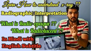 How to understand dental XRAY  Radiographic interpretation  dental radiograph [upl. by Aihcrop]