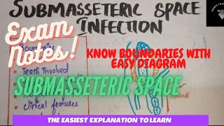 Submasseteric space infectionboundariesclinical featurestreatment easy notesquick explanation [upl. by Acirderf]