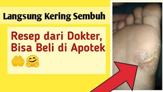 Gatel Telapak Kaki Jadinya Sampe Parah Gini Di Obatin Pake Resep Dokter Beli Di Apotek Murah [upl. by Eelorac]