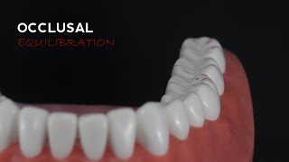 01B Occlusal Equilibration [upl. by Yekciv480]