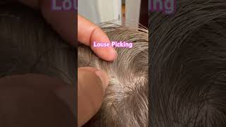 Lice removal service l nit picking l small business explore hair lice nomorelice [upl. by Etnohs]