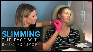 Slimming the Face with BOTOX and Dysport in San Francisco [upl. by Rowan225]