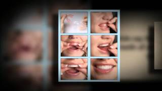 Hydrogen Peroxide Teeth Whitening [upl. by Shelly]