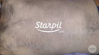 How to Wax Mens Back Hair  Full Back Hair Removal  Starpil Wax [upl. by Enymsaj592]