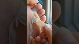 Foot Peel Mask for baby soft feet and no more cracked heels or calluses ✨ How To Get Rid of Dry Feet [upl. by Holloway]