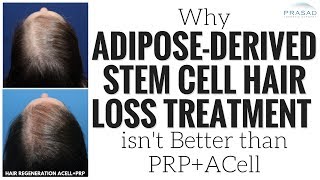 Why Adipose Derived Stem Cell Hair Loss Treatment has No Advantage over ACellPRP [upl. by Gillette43]