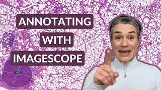 Aperio ImageScope  Free Annotation Tool for Pathology [upl. by Zilla]