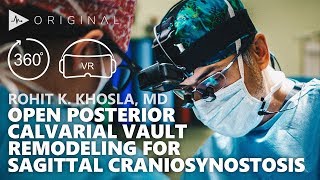 Open Posterior Calvarial Vault Remodeling for Sagittal Craniosynostosis  Dr Rohit Khosla [upl. by Zurek]