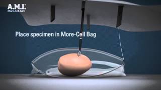 Contained power morcellation in a bag with AMI MoreCellSafe – 3D animated video [upl. by Lekzehcey]