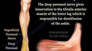 Foot Drop Peroneal Nerve Injury  Everything You Need To Know  Dr Nabil Ebraheim [upl. by Herzen201]