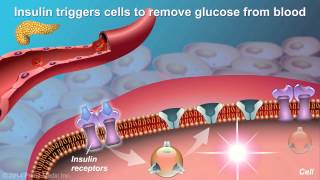 Understanding Type 2 Diabetes [upl. by Nannaihr]