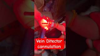 Vein ditector  finder cannulation  cannula trending newbornbaby veindiseaseSMpharmacy [upl. by Haroppiz518]