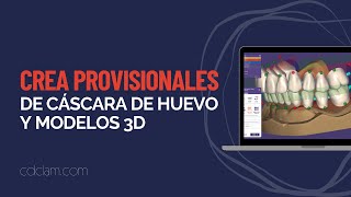 ¡Crea Provisionales de Cáscara de Huevo y Modelos 3D adaptados a tu diseño como un PRO EXOCAD [upl. by Arvonio]