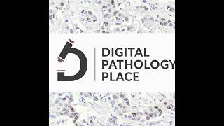 104 DigPath Digest 12 AI in Pathology From Retinal Screening to Global Cancer Diagnostics  m [upl. by Sitra352]