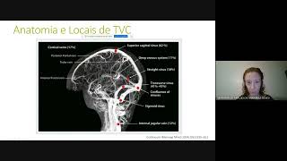 Curso Neurovascular  Trombose Venosa Cerebral Causas Incomuns e Prevenção Primordial e Primária [upl. by Guthry]