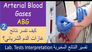 Lecture 2 2 Arterial Blood Gases analysis  ABG [upl. by Norag]