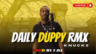 Knuckz  Daily Duppy RMX  GRM DAILY PROD BY FRE [upl. by Aiket]