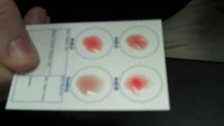 Blood Type Analysis [upl. by Auqeenahs]