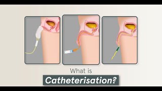 4 Minute Learning Urinary Catheterisation Male amp Care [upl. by Asiela]