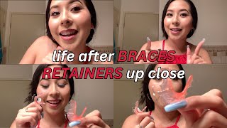 Life After Braces Wearing RETAINERS update  vlog [upl. by Loftus]