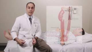 Iliotibial Band Syndrome Physical Exam  Stanford Medicine 25 [upl. by Ellata303]