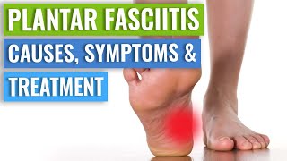 Plantar Fasciitis Causes Symptoms amp Treatment [upl. by Hutchings461]