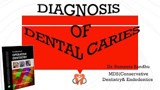 Dental cariesDiagnosis of dental caries [upl. by Dnomsad181]