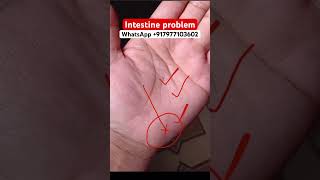 Intestine problem astrology palmanalysis palmistry palmreading palmstudy fortunetelling [upl. by Hughes]