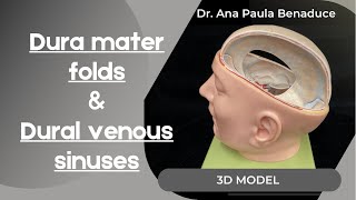 Dr Benaduce Dura Mater Folds amp Dural Venous Sinuses  3D Model [upl. by Grethel]