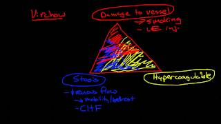 Thromboembolic Disease Deep Vein Thrombosis and Pulmonary Embolism [upl. by Mireielle]