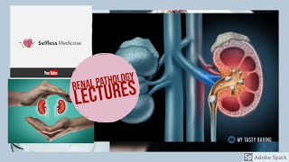 RENAL PATHOLOGY lecture 16 NEPHROSCLEROSIS [upl. by Yrral]