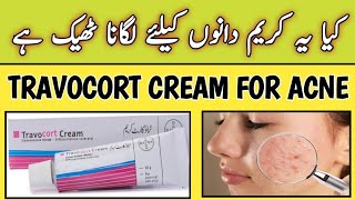 best use of travocort cream  pustular psoriasis  eczema on legs  eczema dry skin  eczema patches [upl. by Hands97]