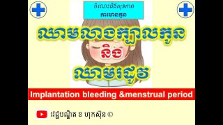 ឈាមលាងក្បាលកូននិង ឈាមរដូវ l Implantation bleeding and menstrual period l វេជ្ជបណ្ឌិត ខ ហុកស៑ុន [upl. by Connie]