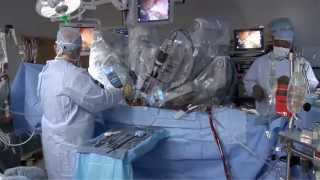 Laparoscopic vs Robotic [upl. by Publia293]