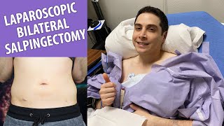 I Got Sterilized My Experience amp Recovery  Laparoscopic Bilateral Salpingectomy [upl. by Gnilrits]