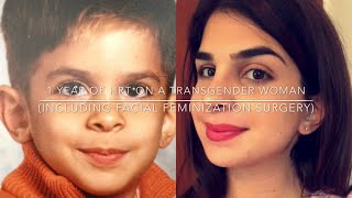 MaletoFemale transition  1 year of HRT on a transgender woman including FFS [upl. by Ynnol]