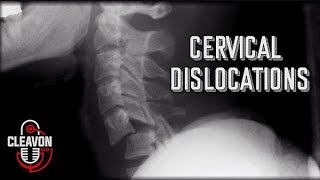 Cleavon MD  Cervical Dislocations [upl. by Faludi]