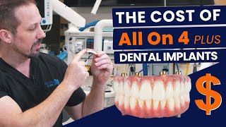 True Cost of All On 4 Plus® Dental Implants [upl. by Gnues]