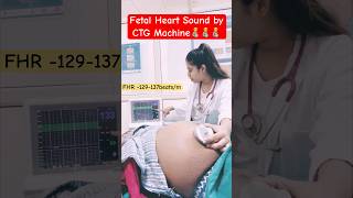 fetal heart sound by CTG machineroutine care [upl. by Mayrim845]