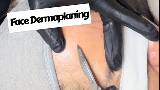 Dermaplaning Treatment facial dermaplaning satisfying beauty aesthetics blackheadremoval [upl. by Htrag243]