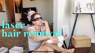 At Home Hair Removal BOSIDIN Laser from AMAZON  UNBOXING plus First Treatment [upl. by Inej957]