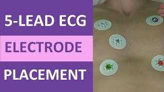 5 Lead ECG Placement of Electrodes EKG NCLEX amp Nursing Mnemonic [upl. by Oigres89]